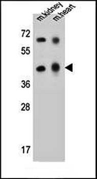  Western blot analysis of mouse kidney,heart tissue lysates using ADAL antibody