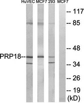 Western blot analysis of extracts from HuvEc cells, MCF-7 cells and 293 cells using PRPF18 antibody