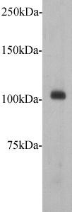 Western Blot analysis of mouse spinal cord using Meckelin antibody