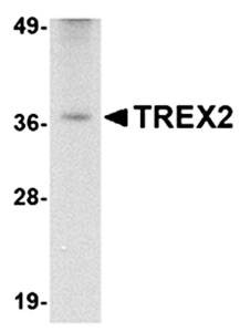 Western blot analysis of rat liver tissue lysate at 2.5 ug/mL using TREX2 antibody 