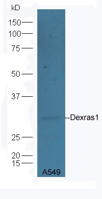 Western blot analysis of mouse liver lysates using Dexras1 antibody