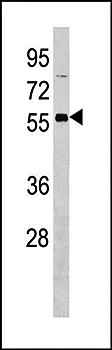 Western blot analysis of Jurkat cell line lysates (35ug/lane) using OXCT2 antibody (Center)