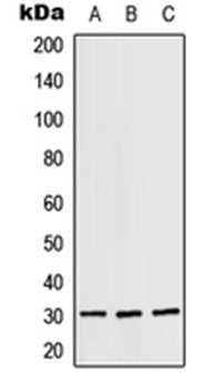 Western blot analysis of A431 (Lane 1), SP2/0 (Lane 2), H9C2 (Lane 3) whole cell lysates using RPS4X antibody 
