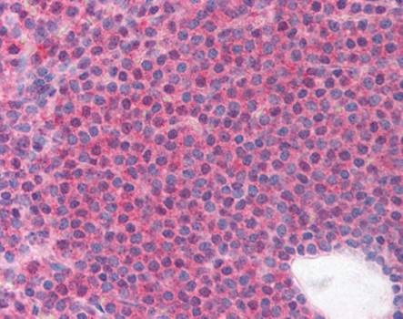 Immunohistochemical staining of paraffin embedded human spleen tissue using LRRC3B antibody (primary antibody at 1:200)