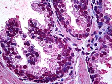 Immunohistochemical staining of paraffin embedded human prostate tissue using OSR1 antibody (primary antibody at 1:200)