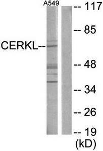 Western blot analysis of extracts from A549 cells using CERKL antibody