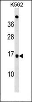 Western blot analysis of K562 cell line lysates (35ug/lane) using UBE2D4 antibody (C-term)