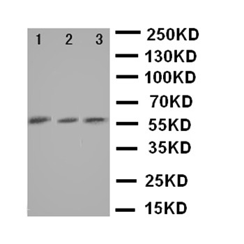 Western blot analysis of Lane 1: HELA Cell Lysate, Lane 2: 293T Cell Lysate, Lane 3: JURKAT Cell Lysate using CYP7A1 antibody 