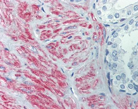 Immunohistochemical staining of paraffin embedded human prostate tissue using SLC39A10 antibody (primary antibody at 1:200)