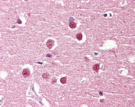 Immunohistochemical staining of paraffin embedded human brain tissue using GPR98 antibody (primary antibody at 1:200)