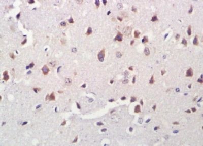 Immunohistochemical analysis of formalin-fixed paraffin embedded rat brain tissue using A2LD1 antibody (dilution at 1:200)