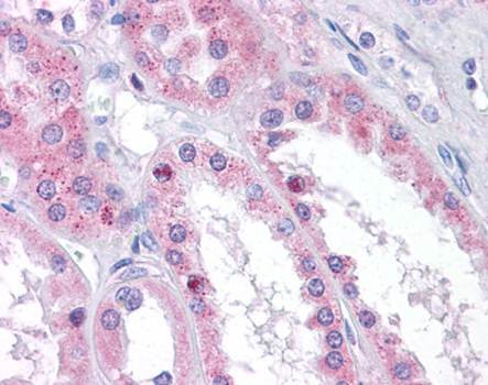 Immunohistochemical staining of paraffin embedded human kidney tissue using CTMP antibody (primary antibody at 1:200)
