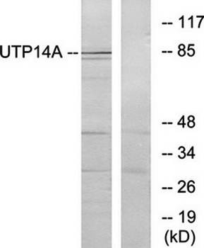Western blot analysis of extracts from HeLa cells using UTP14A antibody