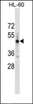 Western blot analysis of HL-60 cell line lysates (35ug/lane) using PRAMEF14 antibody (Center)