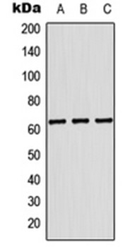 Western blot analysis of THP1 (Lane 1), Raw264.7 (Lane 2), PC12 (Lane 3) whole cell lysates using KRT84 antibody