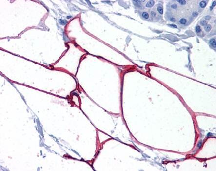 Immunohistochemical staining of paraffin embedded human adipocytes tissue using PLIN4 antibody (primary antibody at 1:200)