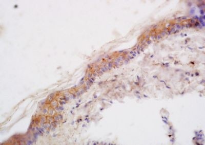 Immunohistochemical analysis of formalin-fixed paraffin embedded rat skin tissue using LCE2B antibody (dilution at 1:200)