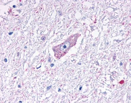 Immunohistochemical staining of paraffin embedded human brain tissue using MRGD antibody (primary antibody at 1:200)