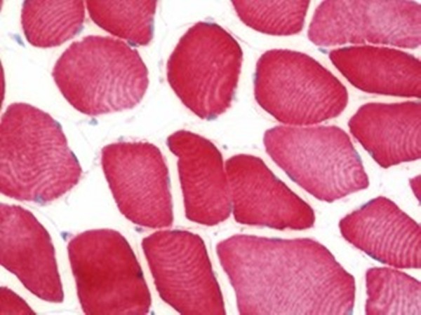 Immunohistochemical analysis of formalin-fixed and paraffin-embedded human skeletal muscle tissue using FAM26F antibody