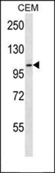 Western blot analysis of CEM cell line lysates (35ug/lane) using RHBDF2 antibody 