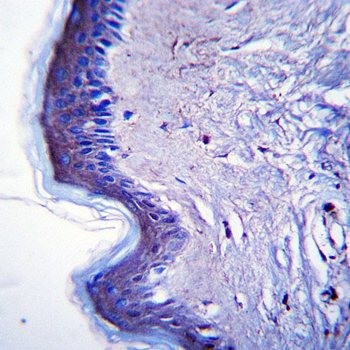  Immunohistochemical analysis of formalin-fixed paraffin embedded human skin tissue using RHBDF2 antibody