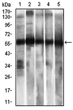 Western blot analysis of HepG2, A549 cell lysate and Rat liver, Mouse liver, Mouse brain tissue lysate using ALDH2 antibody