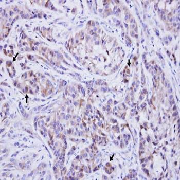  Immunohistochemical analysis of formalin-fixed and paraffin-embedded xenograft using TTLL1 antibody