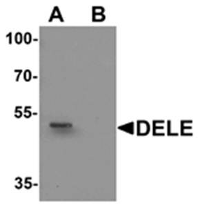 Western blot analysis of rat brain tissue lysate at 1 ug/mL in (A) the absence and (B) the presence of blocking peptide using DELE antibody