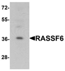 Western blot analysis of 293 cell lysate at 1 ug/mL using RASSF6 antibody