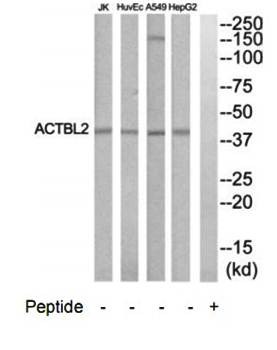 Western blot analysis of extracts from HepG2, HuvEc, Jurkat and A549 cells using ACTBL2 antibody