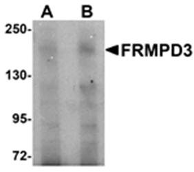 Western blot analysis of Jurkat cell lysate at (A) 1 and (B) 2 ug/mL using FRMPD3 antibody 