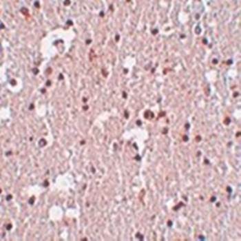 Immunohistochemical analysis of formalin-fixed and paraffin-embedded human brain tissue at 5 ug/mL using FRMPD3 antibody