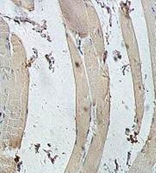 Immunohistochemical analysis of formalin-fixed paraffin embedded fetal skeletal muscle staining using USP38 antibody 
