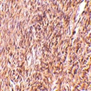  Immunohistochemical analysis of formalin-fixed and paraffin-embedded mouse ovary tissue at 10 ug/mL using TRIM30 antibody