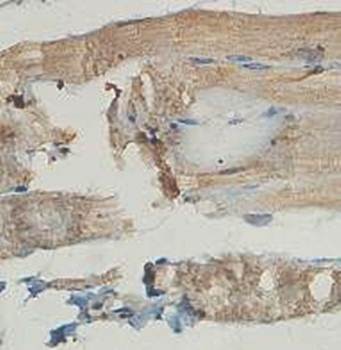 Immunohistochemical analysis of formalin-fixed paraffin embedded fetal skeletal muscle showing cytoplasmic staining using AMPD3 antibody 