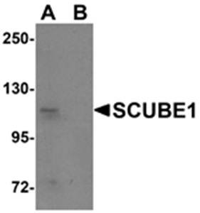 Western blot analysis of Daudi cell lysate at 1 ug/mL in (A) the absence and (B) the presence of blocking peptide using SCUBE1 antibody 