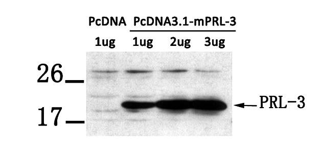 Western blot analysis of PRL-3 antibody in LX-2 cells lysates