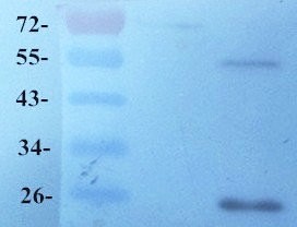  Western blot analysis of Rat liver tissue using GPR55 antibody dilution at (1:100)