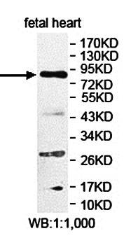 Western blot analysis of fetal heart lysate using LCA5 antibody 