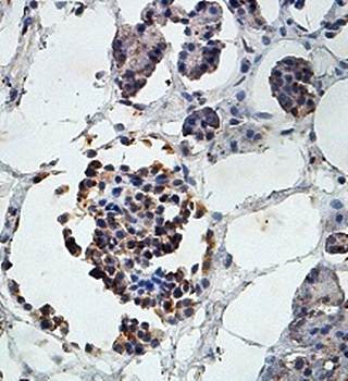 Immunohistochemical analysis of formalin-fixed paraffin embedded fetal pancreas showing cytoplasmic staining using LCA5 antibody