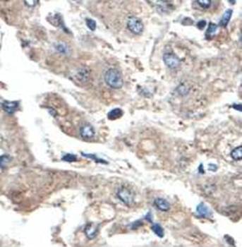 Immunohistochemical analysis of formalin-fixed paraffin embedded fetal liver showing cytoplasmic staining using ACER2 antibody