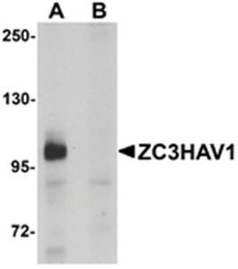 Western blot analysis of HeLa cell lysate at 1ug/mL in (A) the absence and (B) the presence of blocking peptide using ZC3HAV1 antibody 