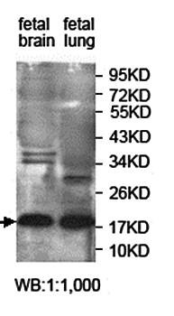 Western blot analysis of fetal brain and fetal lung lysate using JTB antibody 