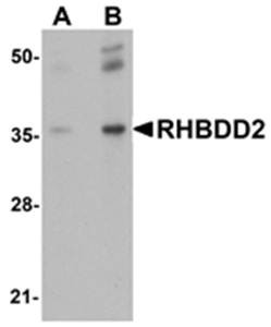 Western blot analysis of rat lung tissue lysate at (A) 1 and (B) 2 ug/mL using RHBDD2 antibody