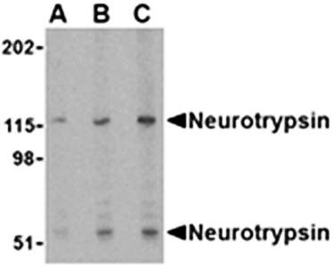 Western blot analysis of SK-N-SH cell lysate at (A) 0.5, (B) 1 and (C) 2 ug/mL using Neurotrypsin antibody 