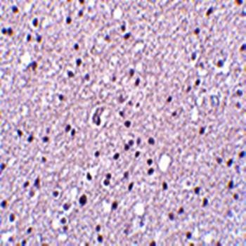  Immunohistochemical analysis of formalin-fixed and paraffin-embedded human brain tissue at 2.5 ug/mL using Neurotrypsin antibody
