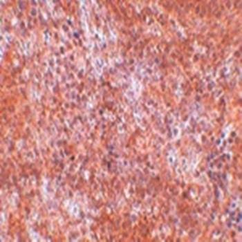  Immunohistochemical analysis of formalin-fixed and paraffin-embedded mouse spleen tissue at 2.5 ug/mL using JMJD8 antibody