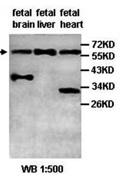 Western blot analysis of fetal brain,liver and heart lysate using ACBD5 antibody 