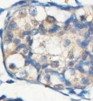  Immunohistochemical analysis of formalin-fixed paraffin embedded fetal testis showing membrane staining using ACBD5 antibody