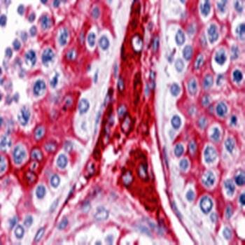 Immunohistochemical analysis of formalin-fixed and paraffin-embedded human testis tissue at 5 ug/mL using WDR35 antibody